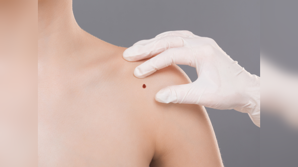 Case study stresses on knowing signs of cancer