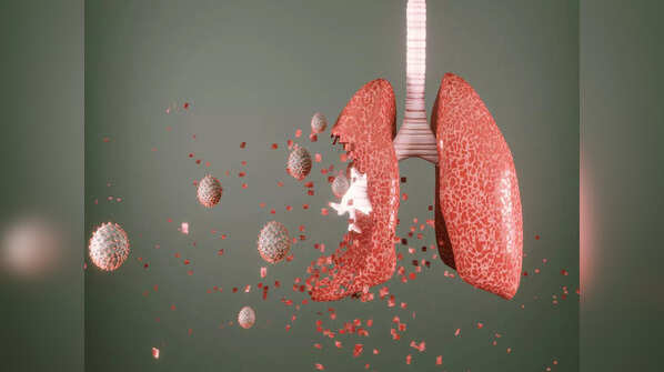 Incorrect COVID-19 pneumonia diagnosis