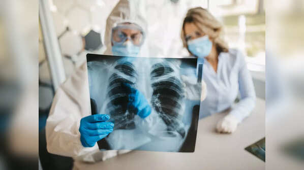 X-rays of her chest