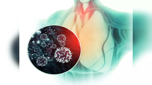 True diagnosis: Stage 4 non-small cell lung cancer