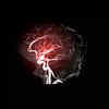 Headaches that are sudden and severe