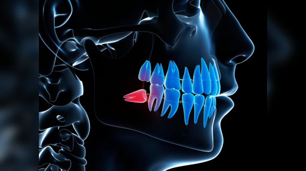 Infection