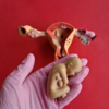 The uterus is three layered