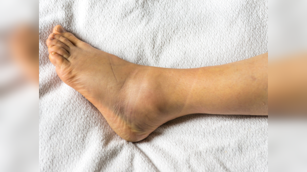Infection and treadmill injury