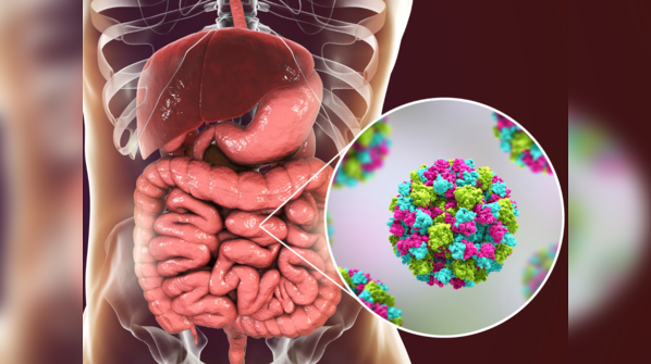 Symptoms of norovirus