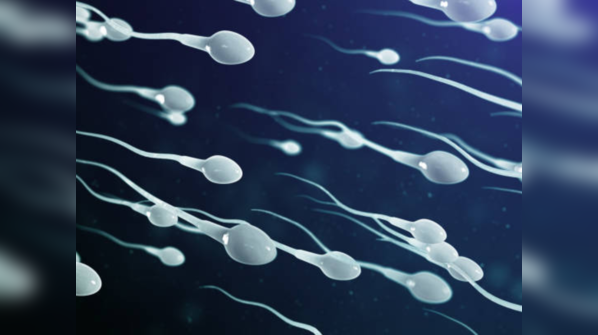 What is sperm donation?