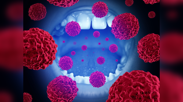 Mouth cancer is common in India