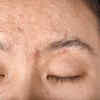 Swelling in your face and feet, puffiness around your eyes