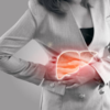 Myth: I am physically active, I won't get fatty liver