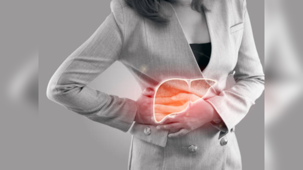 Myth: I am physically active, I won't get fatty liver