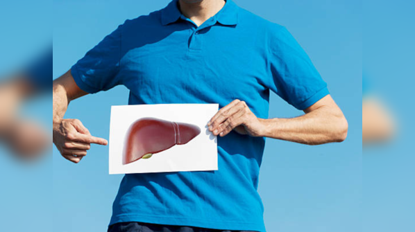 What is fatty liver?