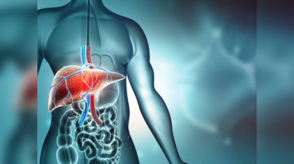 Myth: Fatty liver is not that common