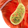 Fever, Lack of appetite and weight loss 
