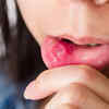 But STIs can transmit through non-penetrative sex too