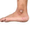 Discoloration or patches on skin