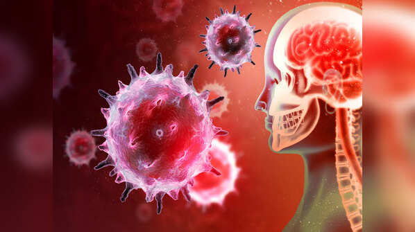 Misdiagnosis