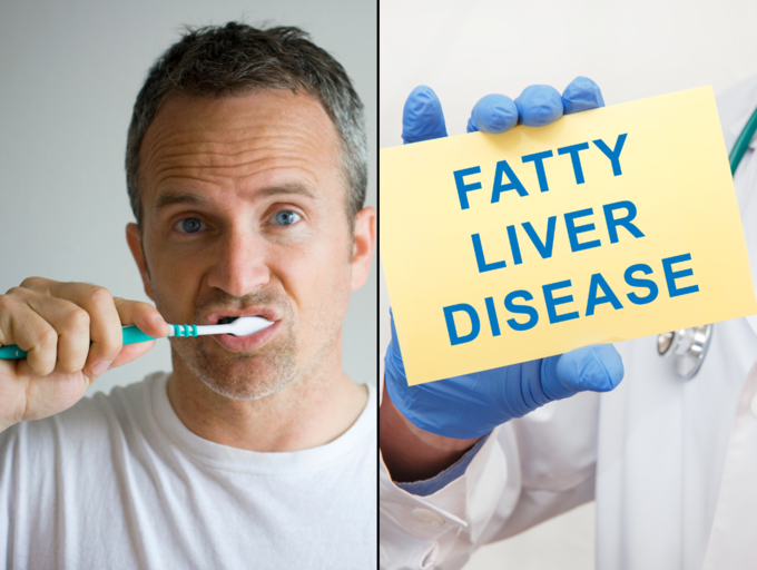 THIS sign while brushing your teeth could signal severe fatty liver