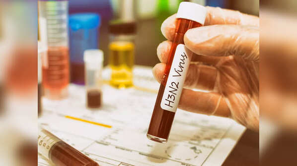 Recover from inluenza virus with these superfoods