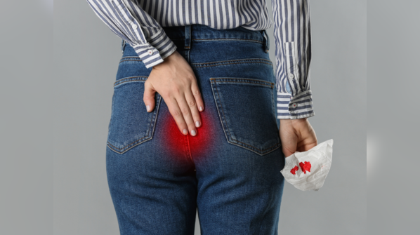 Rectal bleeding: 