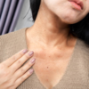 ​Darker skin on neck​