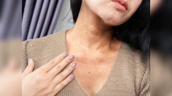 Darker skin on neck