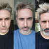 His hair transformation