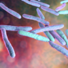​Surgery revealed Mycobacterium marinum infection​