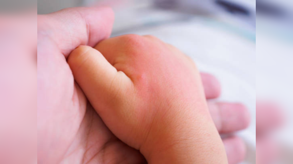 Information about iguana bite-infections is limited