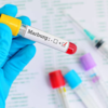 How does the Marburg virus spread?