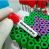 ​What are the symptoms of Marburg disease?​