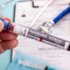 ​What is Marburg virus?​