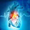 ​Inflammation of the heart​