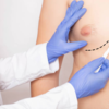 ​Side effects of treatment​