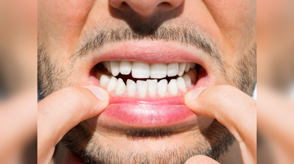 Maintaining a good oral health is important