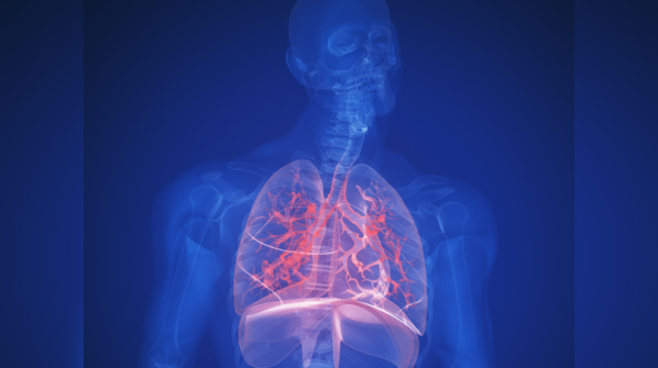 4 mechanisms of poor gum health that can worsen pneumonia: