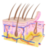 ​Inflamed hair follicles​