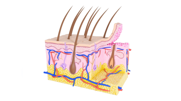 Inflamed hair follicles