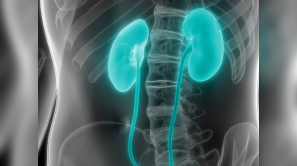 Myth: Kidney cancer surgery leads to removal of the kidneys