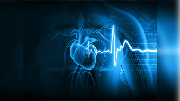 What is a silent heart attack?
