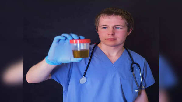 Other causes of smelly urine