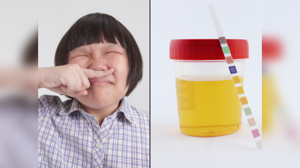 Healthy urine shouldn’t have a strong odor