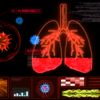 ​Impact on stomach and lungs​