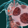 ​​Palliative care:​