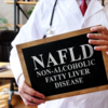 ​​Signs of non-alcoholic fatty liver disease​