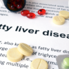 ​​What is non-alcoholic alcoholic fatty liver?​