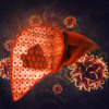 ​​What is alcoholic fatty liver?​