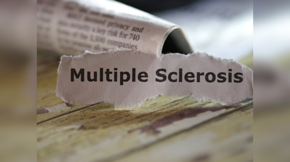 Multiple sclerosis