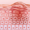 ​Growing the good skin surgically​