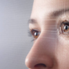 ​Corneal arcus​