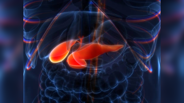 Diabetes and pancreatic cancer